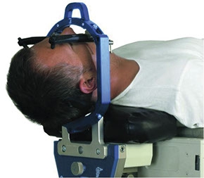 Stereotactische Radiochirurgie